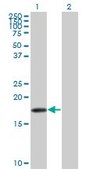 Monoclonal Anti-SNCB antibody produced in mouse clone 3H4, purified immunoglobulin, buffered aqueous solution