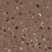 Anti-Ppfibp1 Antibody Produced In Rabbit Prestige Antibodies&#174; Powered by Atlas Antibodies, affinity isolated antibody, buffered aqueous glycerol solution