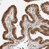 Anti-ADPRHL2 antibody produced in rabbit Prestige Antibodies&#174; Powered by Atlas Antibodies, affinity isolated antibody, buffered aqueous glycerol solution