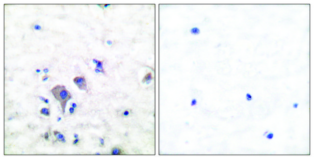 Anti-MGLUR2 antibody produced in rabbit affinity isolated antibody