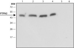 Anti-PTPN2 antibody produced in rabbit ~1.5&#160;mg/mL, affinity isolated antibody