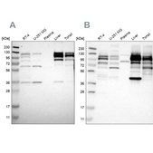 Anti-RRBP1 antibody produced in rabbit Prestige Antibodies&#174; Powered by Atlas Antibodies, affinity isolated antibody, buffered aqueous glycerol solution
