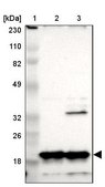 Anti-NDUFB8 antibody produced in rabbit Prestige Antibodies&#174; Powered by Atlas Antibodies, affinity isolated antibody, buffered aqueous glycerol solution