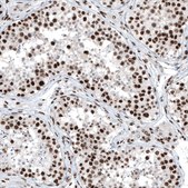 Anti-BRD4 antibody produced in rabbit Prestige Antibodies&#174; Powered by Atlas Antibodies, affinity isolated antibody, buffered aqueous glycerol solution