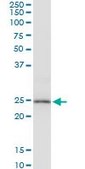 Anti-PRDX3 antibody produced in mouse purified immunoglobulin, buffered aqueous solution