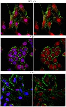 Anti-Smad4/DPC4 Antibody from rabbit, purified by affinity chromatography