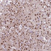 Anti-MGMT antibody produced in rabbit Prestige Antibodies&#174; Powered by Atlas Antibodies, affinity isolated antibody