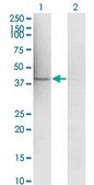 Monoclonal Anti-MAP2K1 antibody produced in mouse clone 1B5, purified immunoglobulin, buffered aqueous solution