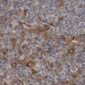 Anti-ARHGEF11 antibody produced in rabbit Prestige Antibodies&#174; Powered by Atlas Antibodies, affinity isolated antibody, buffered aqueous glycerol solution