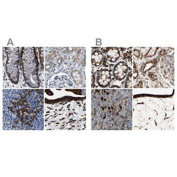 Anti-RRBP1 antibody produced in rabbit Prestige Antibodies® Powered by Atlas Antibodies, affinity isolated antibody, buffered aqueous glycerol solution