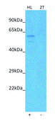 Anti-PDE4D (C-terminal) antibody produced in rabbit affinity isolated antibody