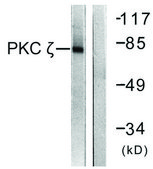 Anti-PKC &#950; antibody produced in rabbit affinity isolated antibody