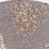 Anti-MKL1 antibody produced in rabbit Prestige Antibodies&#174; Powered by Atlas Antibodies, affinity isolated antibody, buffered aqueous glycerol solution