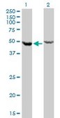 Monoclonal Anti-DDX6 antibody produced in mouse clone 3D2, purified immunoglobulin, buffered aqueous solution