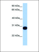 Anti-PRDX6 (AB1) antibody produced in rabbit affinity isolated antibody