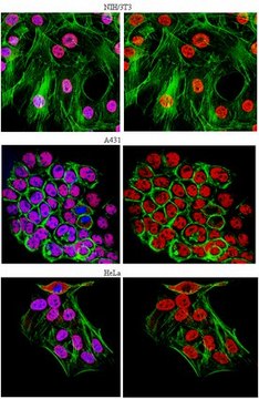 Anti-U1-70K Antibody, clone 9C4.1 clone 9C4.1, from mouse