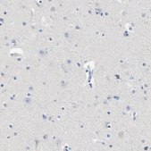 Anti-LCK antibody produced in rabbit Prestige Antibodies® Powered by Atlas Antibodies, affinity isolated antibody, buffered aqueous glycerol solution