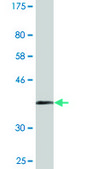 Monoclonal Anti-CALM3 antibody produced in mouse clone 1E2, purified immunoglobulin, buffered aqueous solution