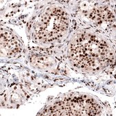 Monoclonal Anti-METTL14 antibody produced in mouse Prestige Antibodies&#174; Powered by Atlas Antibodies, clone CL4252, purified immunoglobulin