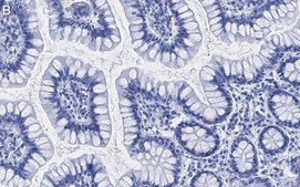 Anti-Nucleolin Antibody, clone 5D13 ZooMAb&#174; Rabbit Monoclonal recombinant, expressed in HEK 293 cells