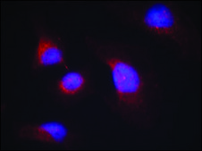 Anti-phospho-SYK (pTyr323) antibody produced in rabbit affinity isolated antibody
