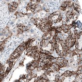 Anti-CLDN3 antibody produced in mouse Prestige Antibodies&#174; Powered by Atlas Antibodies, clone CL13129, purified by using Protein A, buffered aqueous glycerol solution