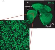 Anti-Brn-3a Antibody, POU-domain protein, clone 5A3.2 culture supernatant, clone 5A3.2, Chemicon&#174;
