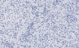 Anti-Integrin αVβ3 Antibody, clone EM22703 ZooMAb® Rabbit Monoclonal recombinant, expressed in HEK 293 cells