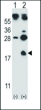 ANTI-HBG1 (CENTER) antibody produced in rabbit IgG fraction of antiserum, buffered aqueous solution