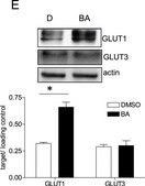 Anti-Glucose Transporter GLUT-1 Antibody, CT Chemicon&#174;, from rabbit