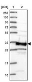 Anti-SMN1 antibody produced in rabbit Prestige Antibodies&#174; Powered by Atlas Antibodies, affinity isolated antibody, buffered aqueous glycerol solution