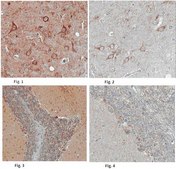 Anti-CELSR1 Antibody from rabbit, purified by affinity chromatography