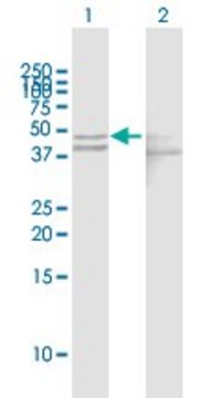 Anti-GOT1 antibody produced in mouse purified immunoglobulin, buffered aqueous solution
