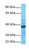 Anti-LDHA antibody produced in rabbit affinity isolated antibody