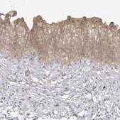 Anti-TBCC antibody produced in rabbit Prestige Antibodies&#174; Powered by Atlas Antibodies, affinity isolated antibody, buffered aqueous glycerol solution