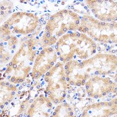 Anti- p38 MAPK antibody produced in rabbit
