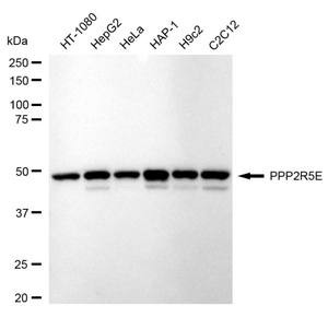 KD-Validated Anti PPP2R5E Antibody, clone 24GB1215, Rabbit Monoclonal clone 24GB1215, recombinant rabbit monoclonal, expressed in HEK293 cells