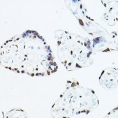 Anti-TEAD1 antibody produced in rabbit