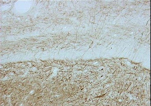 Anti-Neurofilament 200 kDa Antibody, clone N52 clone N52, Chemicon&#174;, from mouse