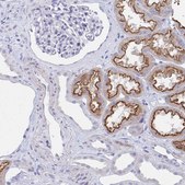 Anti-TNFAIP6 antibody produced in rabbit Prestige Antibodies&#174; Powered by Atlas Antibodies, affinity isolated antibody, buffered aqueous glycerol solution