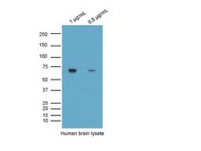 Anti-BACE Antibody, CT Chemicon&#174;, from rabbit