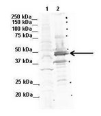 Anti-CNP antibody produced in rabbit IgG fraction of antiserum