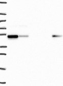 Anti-SNX5 antibody produced in rabbit Prestige Antibodies&#174; Powered by Atlas Antibodies, affinity isolated antibody, buffered aqueous glycerol solution