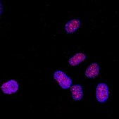 Anti-monomethyl-Histone H3 (Lys4) Antibody Upstate&#174;, from rabbit
