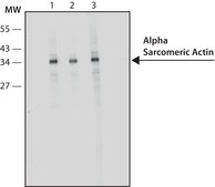 Anti-Actin (&#945;-Sarcomeric) antibody, Mouse monoclonal clone 5C5, hybridoma cell culture supernatant