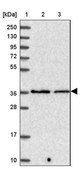 Anti-PPP2CA antibody produced in rabbit Prestige Antibodies&#174; Powered by Atlas Antibodies, affinity isolated antibody, buffered aqueous glycerol solution