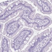 Anti-KRT5 antibody produced in rabbit Prestige Antibodies&#174; Powered by Atlas Antibodies, affinity isolated antibody, buffered aqueous glycerol solution