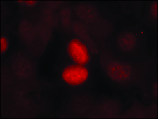 Anti-phospho-FOXO1 (pSer256) antibody produced in rabbit affinity isolated antibody
