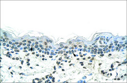 Anti-DLX2 (AB2) antibody produced in rabbit IgG fraction of antiserum