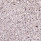 Anti-CHMP4B antibody produced in rabbit Prestige Antibodies&#174; Powered by Atlas Antibodies, affinity isolated antibody, buffered aqueous glycerol solution